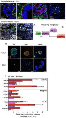 Microenvironment-Induced Non-sporadic Expression of the AXL and cKIT Receptors Are Related to Epithelial Plasticity and Drug Resistance